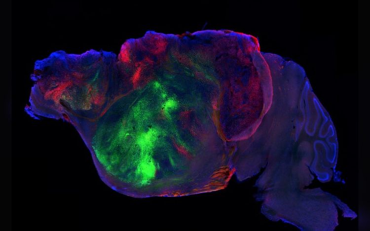 Human organoids restore cognition in mice with half a brain