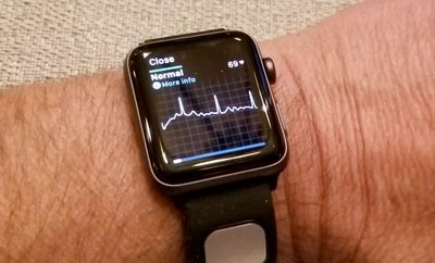 Heart-Healthy Wearables? Believe It