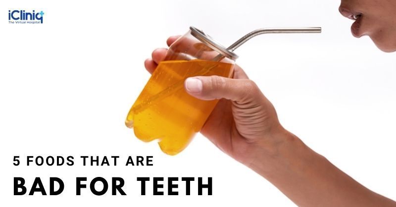 5 Foods That Are Bad for Teeth