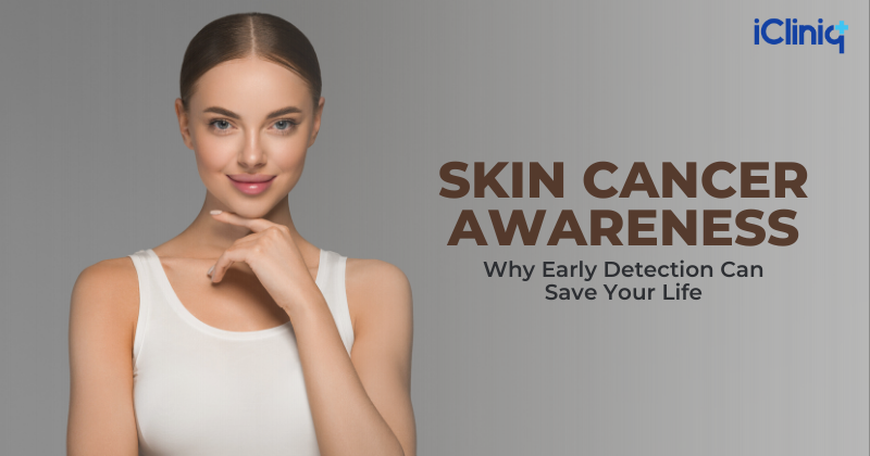 Skin Cancer Awareness: Why Early Detection Can Save Your Life