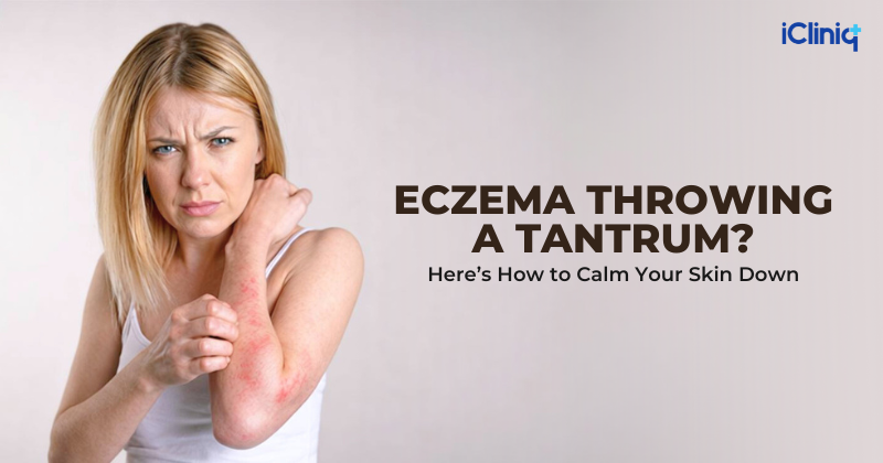 Eczema Throwing a Tantrum? Here’s How to Calm Your Skin Down