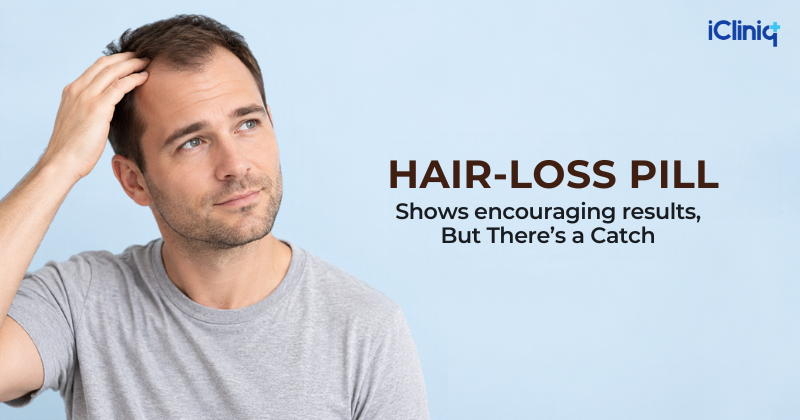 Can a Hair-Loss Pill Help Grow More Hair? The Science Behind It