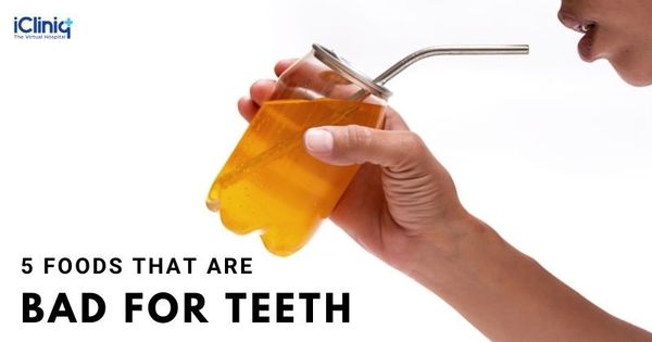 5 Foods That Are Bad for Teeth