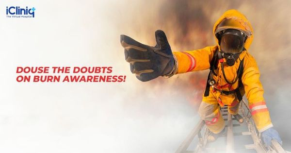 Douse the Doubts on Burn Awareness!