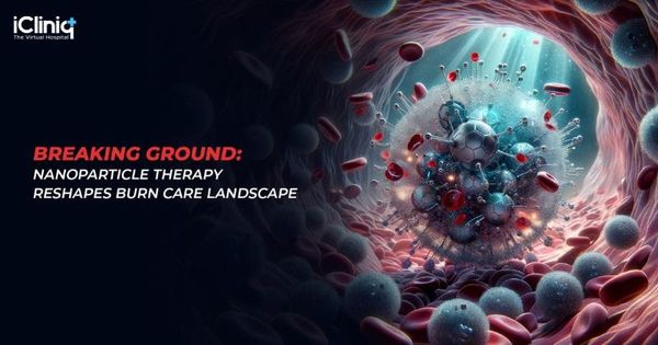Nanoparticle Therapy Reshapes Burn Care Landscape