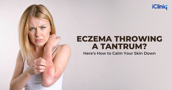 Eczema Throwing a Tantrum? Here’s How to Calm Your Skin Down