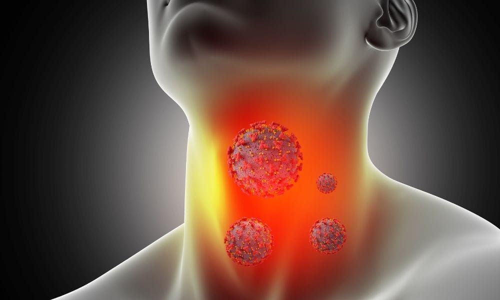 Tratamiento israelí contra el linfoma alcanza tasas de supervivencia del 100% en estudio a gran escala