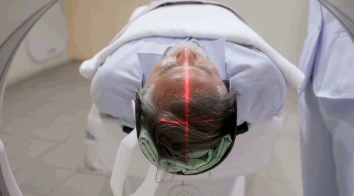 Un estudio demuestra que un"gen de la longevidad" podría protege al cerebro del Alzheimer al reparar su ADN
