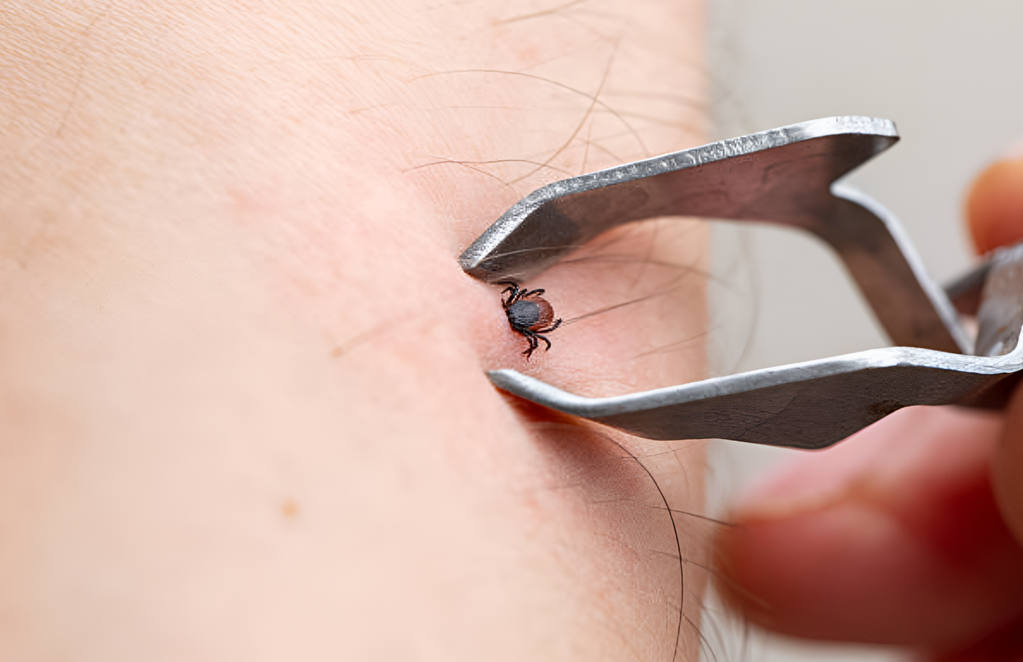Estados Unidos lanza plan federal para frenar el avance de la enfermedad de Lyme