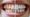 Científicos de la Universidad de Nottingham desarrollan un gel innovador que regenera el esmalte dental dañado