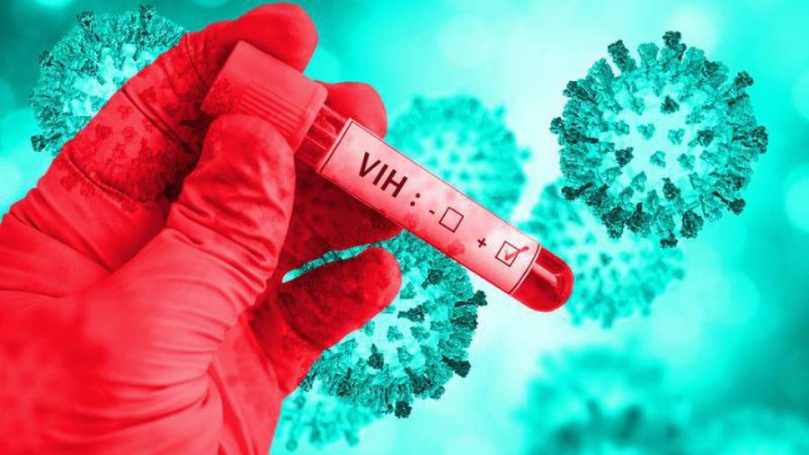 VIH en América Latina: qué dicen los expertos sobre el acceso a la prevención y al tratamiento