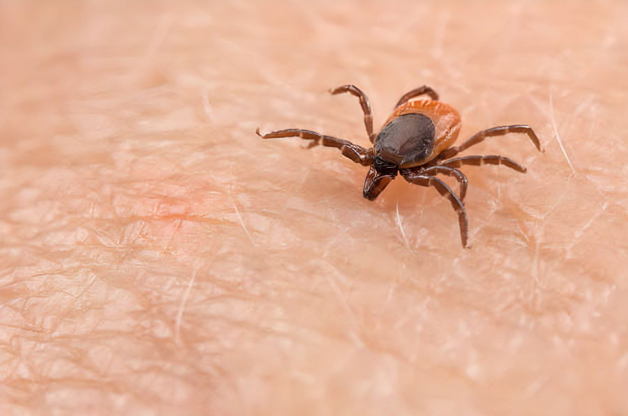 El aumento del 22% en los casos de Lyme en el Reino Unido enciende las alarmas sanitarias