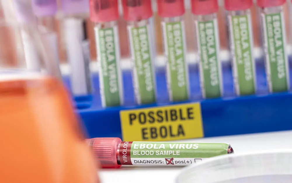 Avusturya’da Ebola şüphesi: Uganda’dan dönen kişi izolasyona alındı