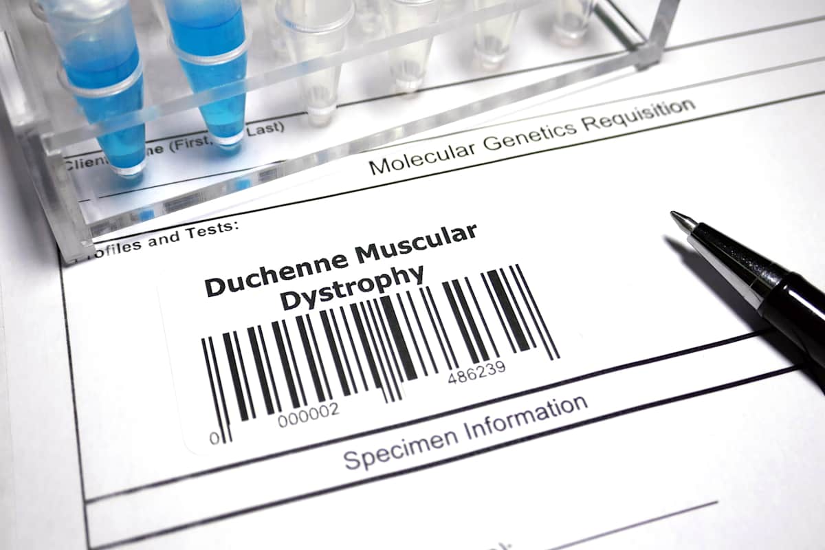 Duchenne muscular dystrophy genetic test