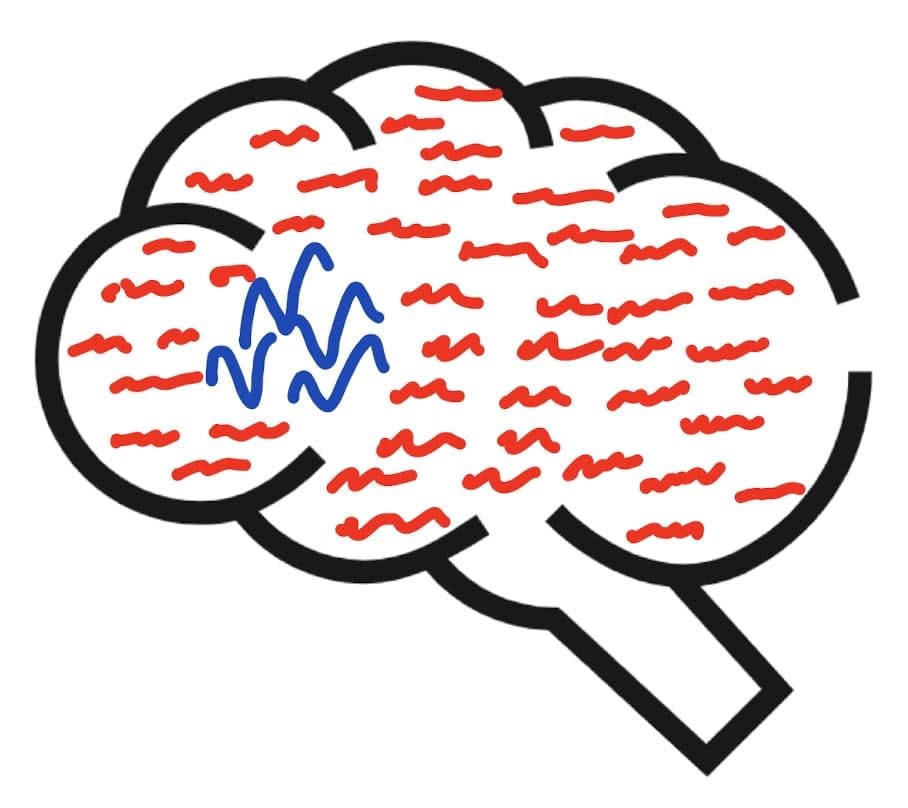 Mind blanking: What happens in our brains when our attention lapses