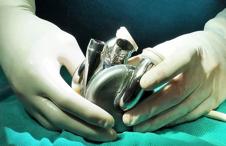 BiVACOR Total Artificial Heart (TAH)