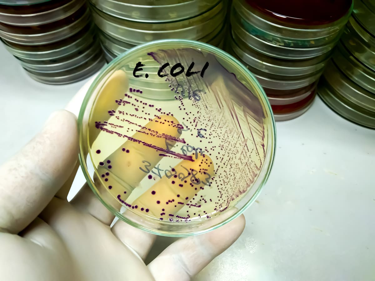 Gloved hand holding a petri dish of bacteria
