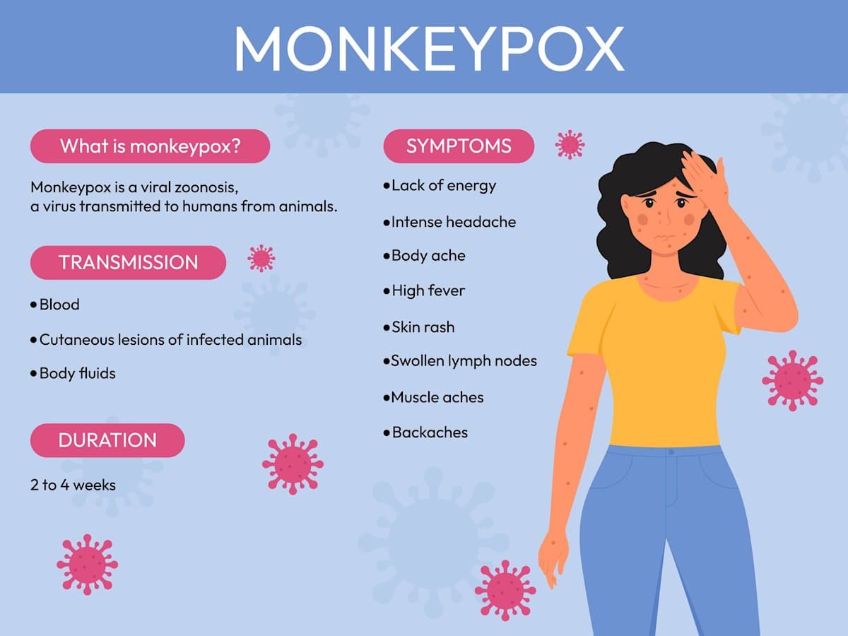 Illustration of Monkeypox symptoms.