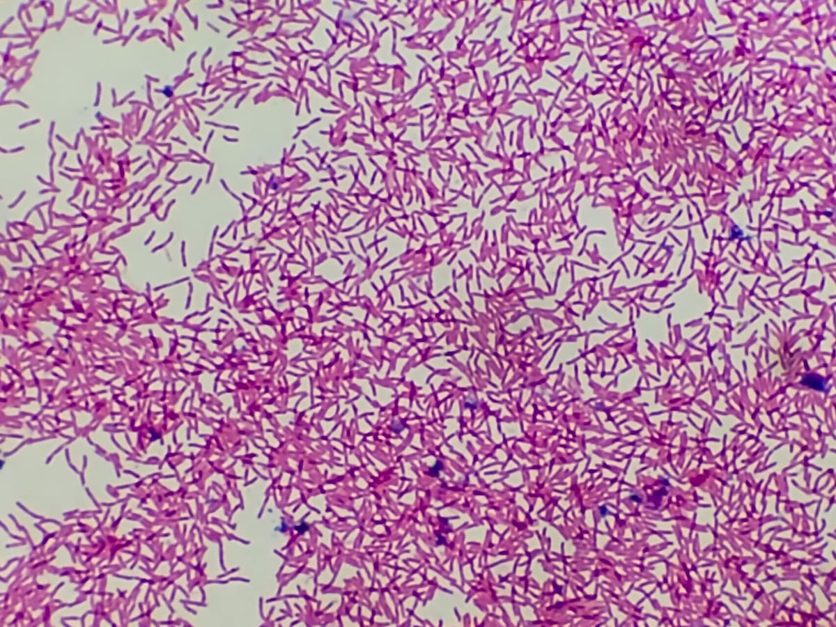 Rod-shaped E. coli bacteria seen under a microscope