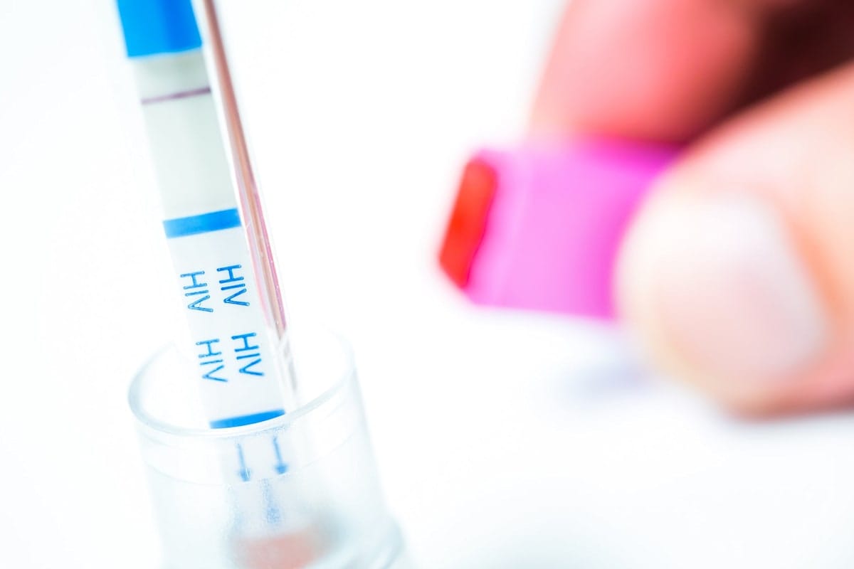 HIV self-test with seronegative result and its lancing device on white background