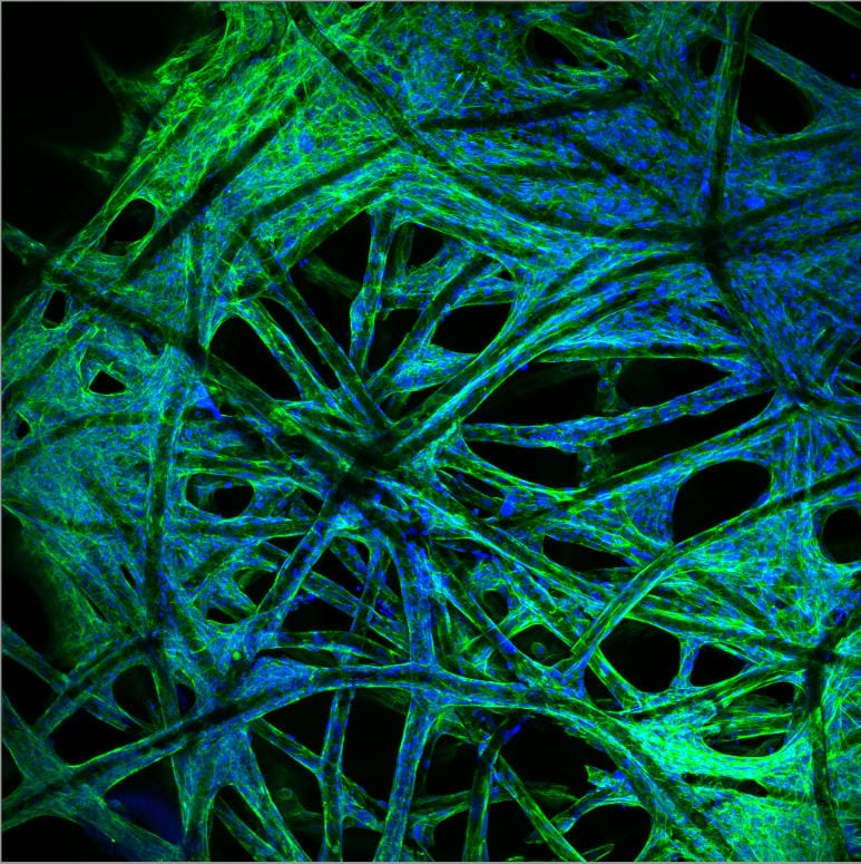 Stromal cells, important in immune response, grown&nbsp;on a 3D-printed scaffold with the cytoskeleton (holding the cells together). shown in green and the cell nuclei stained blue