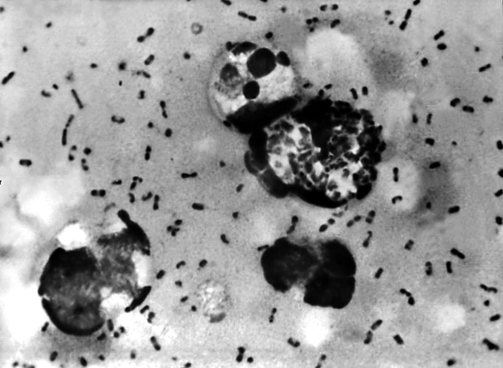 Plague outbreak: where does it still exist and could it spread?