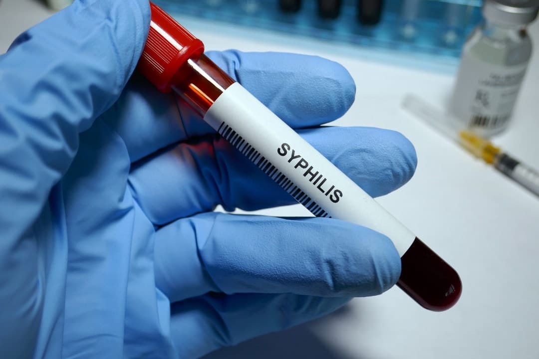 Victoria's sexual health crisis: Services needed to combat alarming rise in STIs