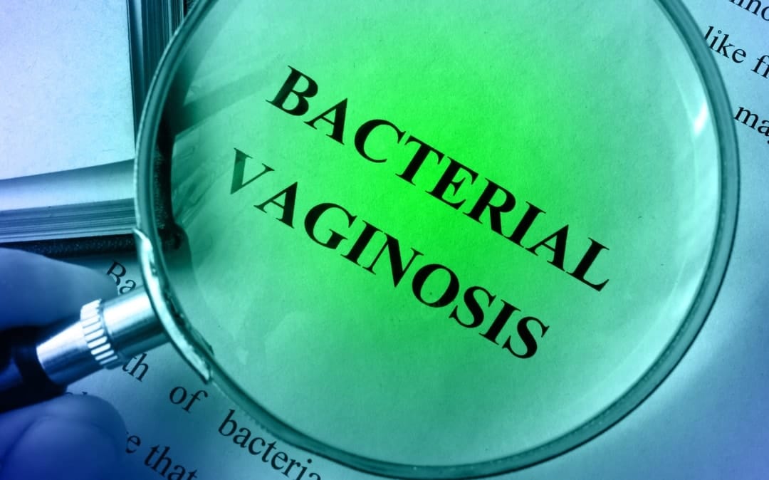 Bacterial vaginosis: a common but little-known condition afflicting women