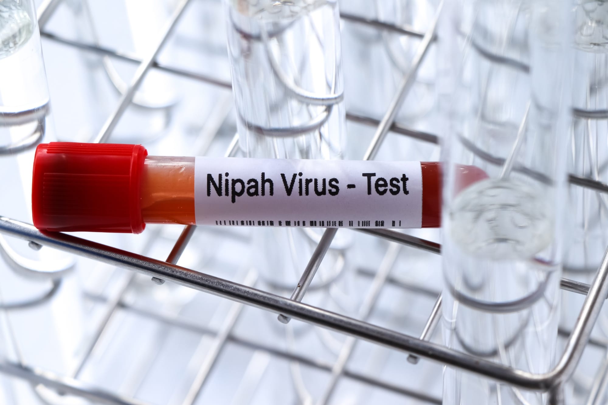 Nipah virus test vial filled with blood on a wire rack 