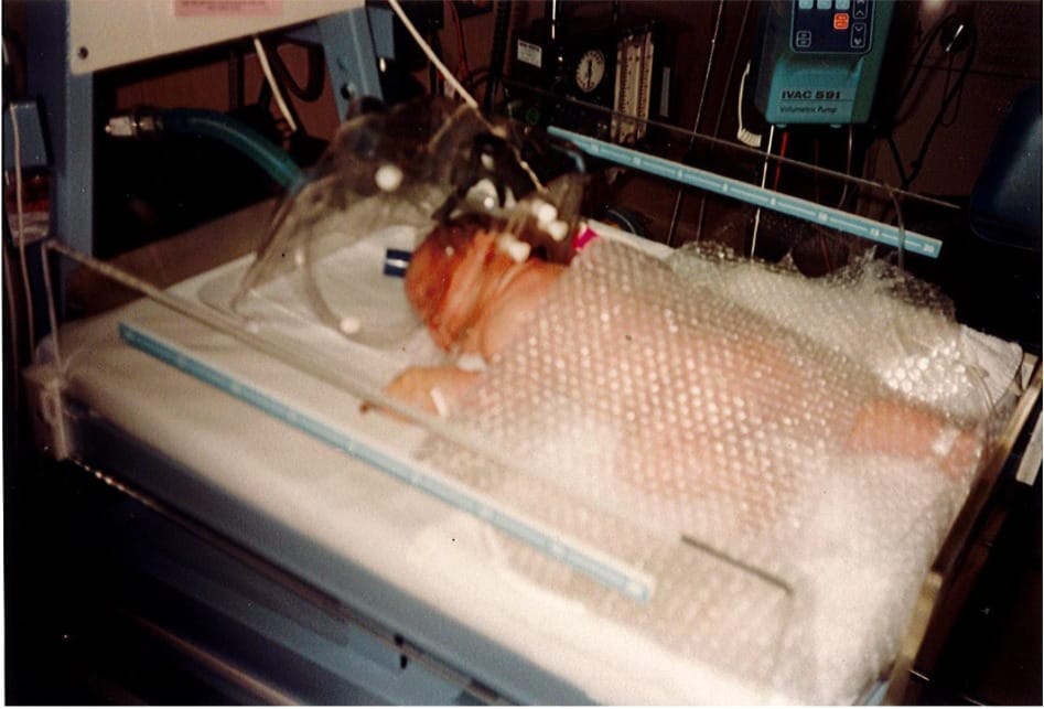 A baby Paige Druce laying covered in a medical bed 