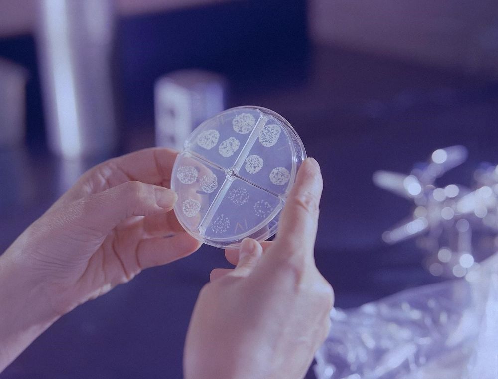 Could food be shaping our gut? The link between diet and the gut microbiome post image