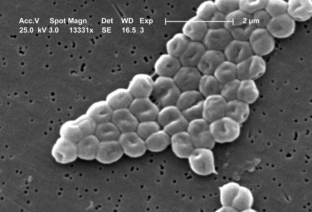 Superbugs have an arsenal of defences – but we've found a new way around them post image