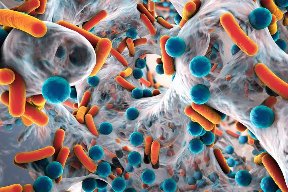 What we can do to slow the rapid rise of superbugs post image