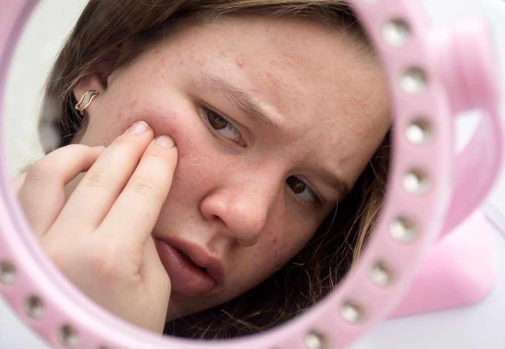 Time to rename PCOS? Global study finds misleading name fuels misdiagnosis post image