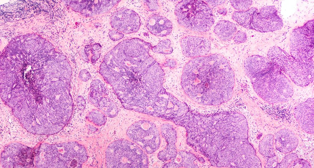 Genetic secrets of almost 2700 cancers unveiled by landmark international project post image