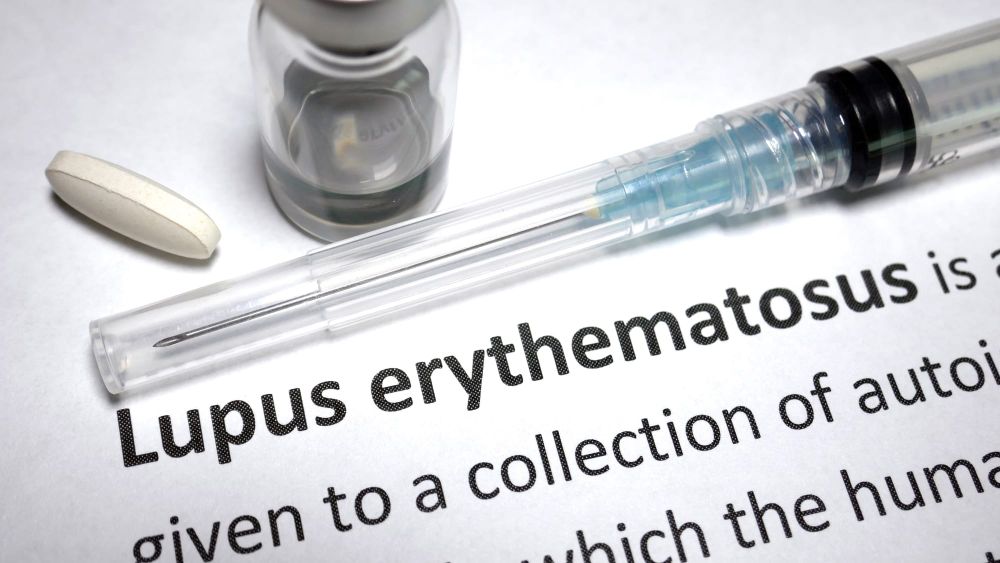 Treatment offers new hope for lupus – and maybe for other autoimmune diseases, too post image