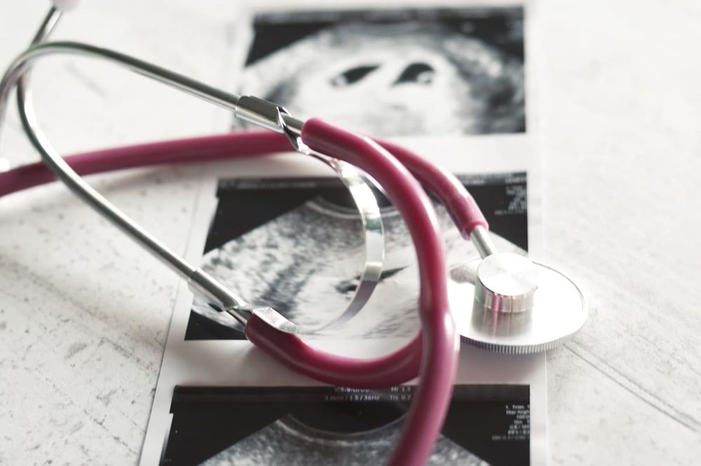 The struggle continues for women to access affordable, timely abortions post image