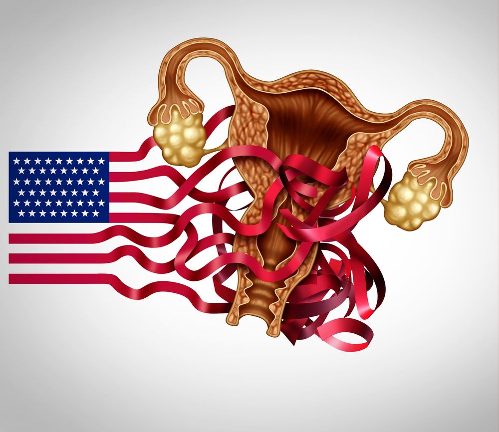 Now that Roe v Wade has been overturned, what are the consequences? post image
