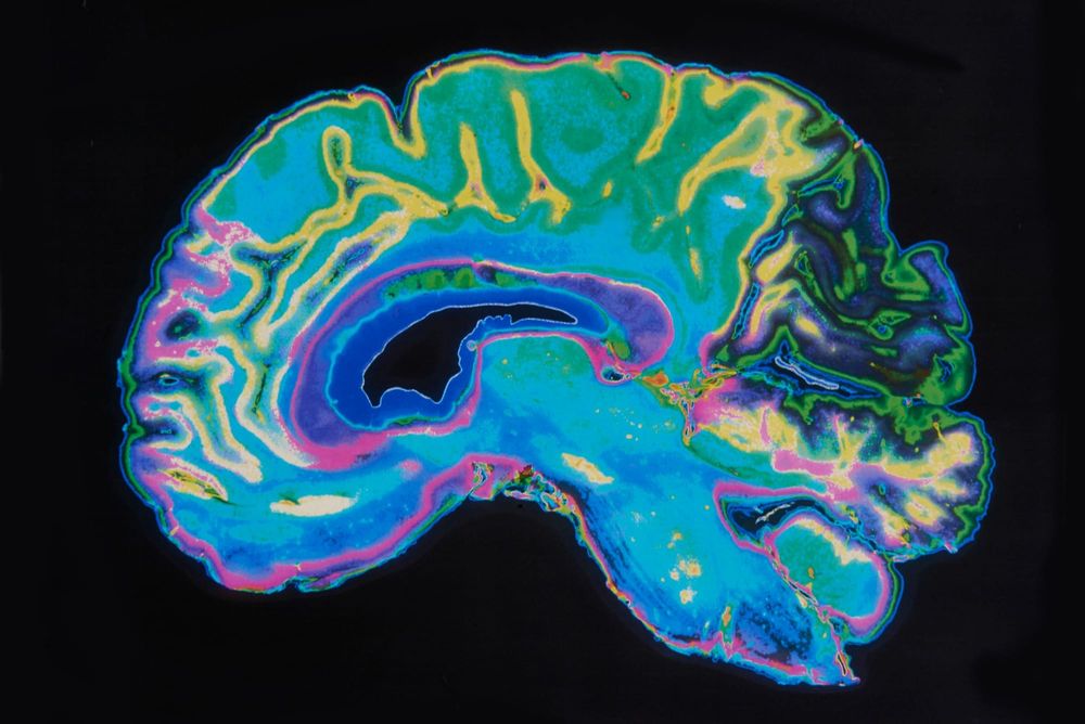 The magic mushroom experience: Taking psilocybin for science post image