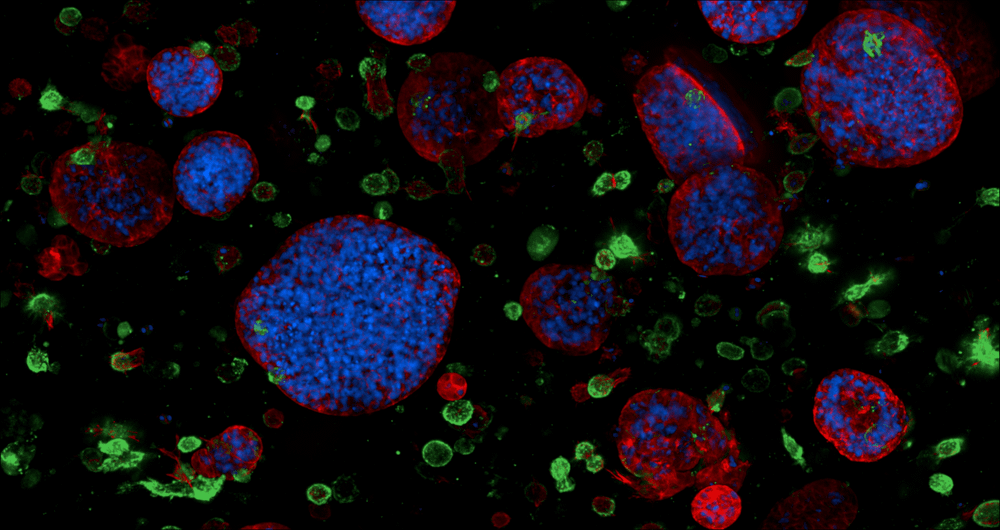Tiny tumour tissues to fight cancer: A model case study for interdisciplinary science post image