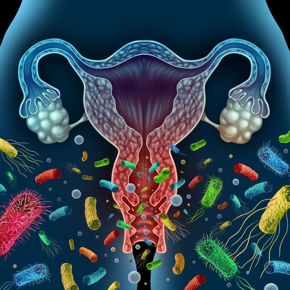 Bacterial vaginosis: New hope for cure through male partner treatment post image