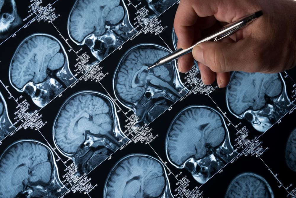 Hospital-acquired infections are bad news – epilepsy could be one more reason why post image
