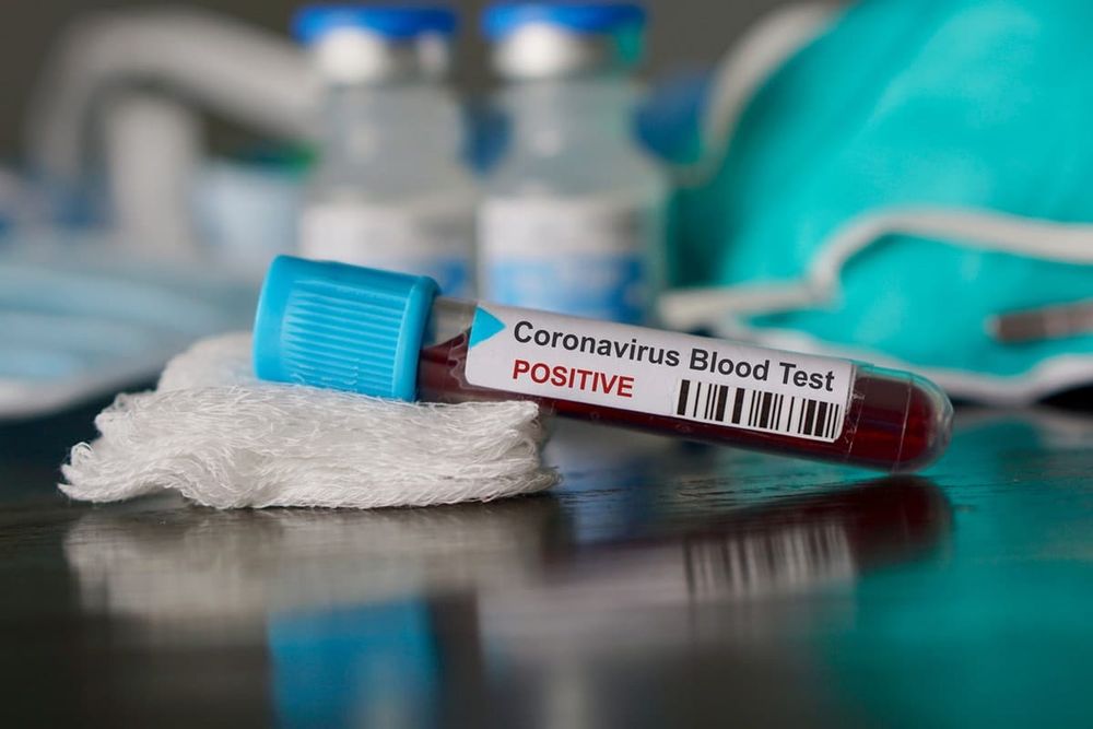 Tested positive for COVID-19? Here's what happens next – and why day five is crucial post image