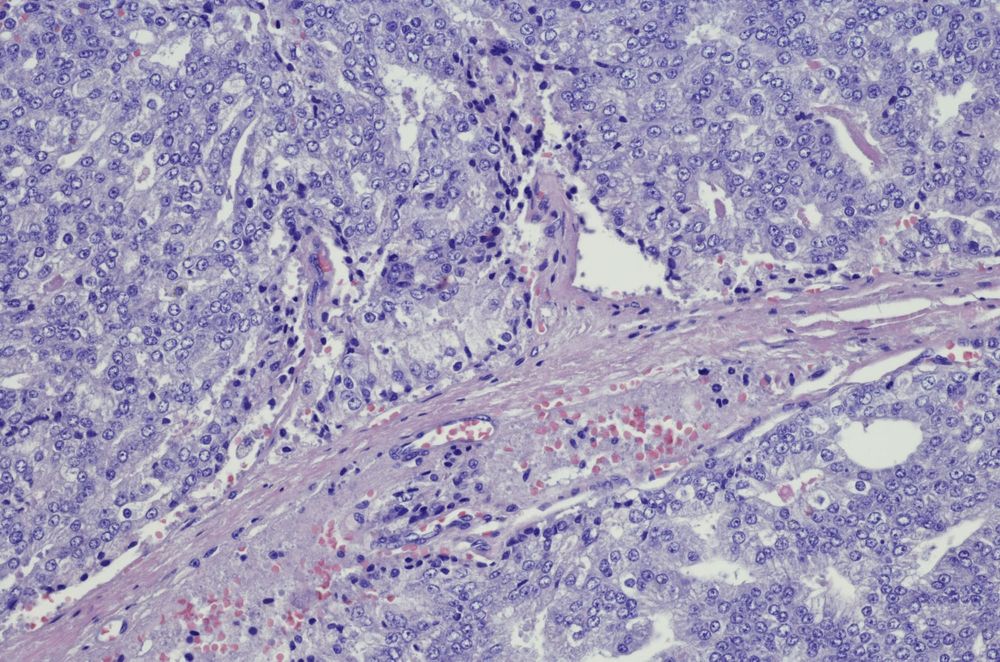 I survived stage four prostate cancer – now I’m meeting the cells that unravelled my world post image