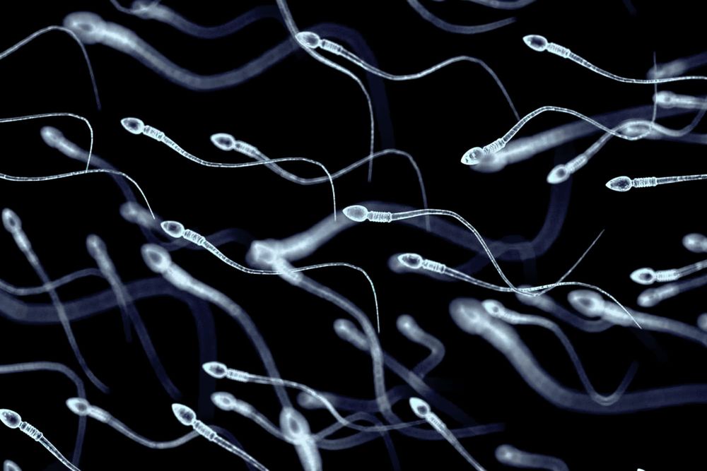 Male infertility is more common than you may think. Here are five ways to protect your sperm post image