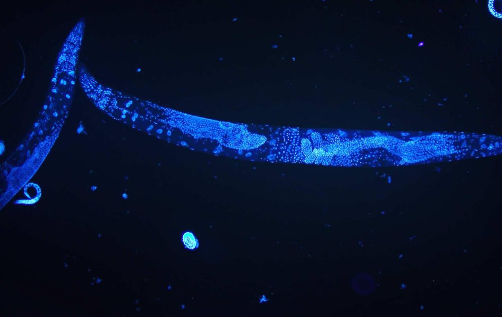 Roundworms and their role in revolutionising human health post image