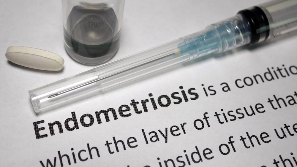 Endometriosis, improving women’s care and the ‘hysteria myth’ post image