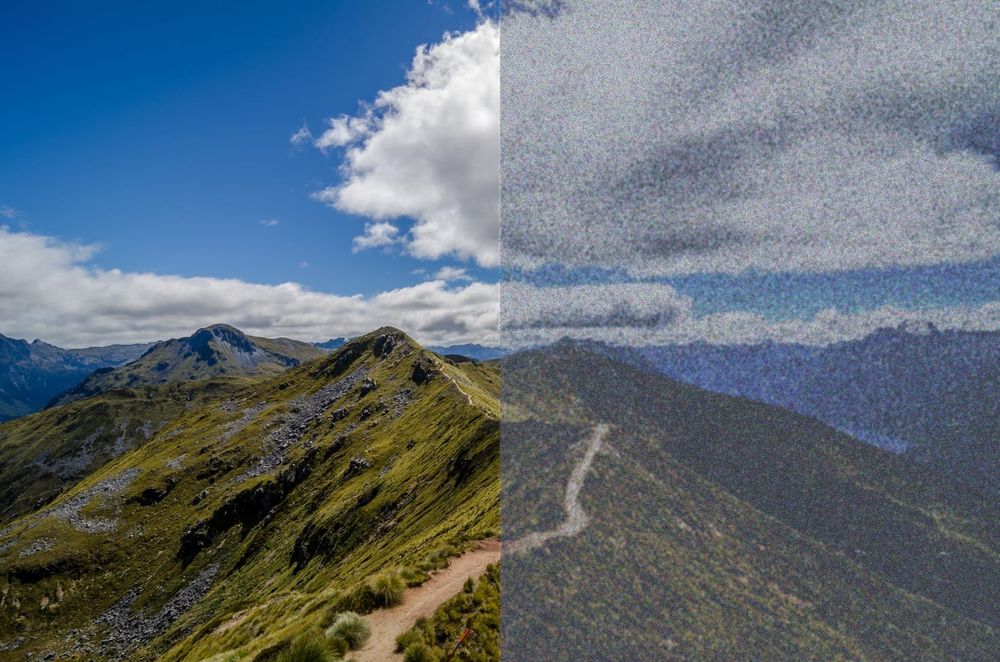 Visual snow: understanding the neurological condition post image