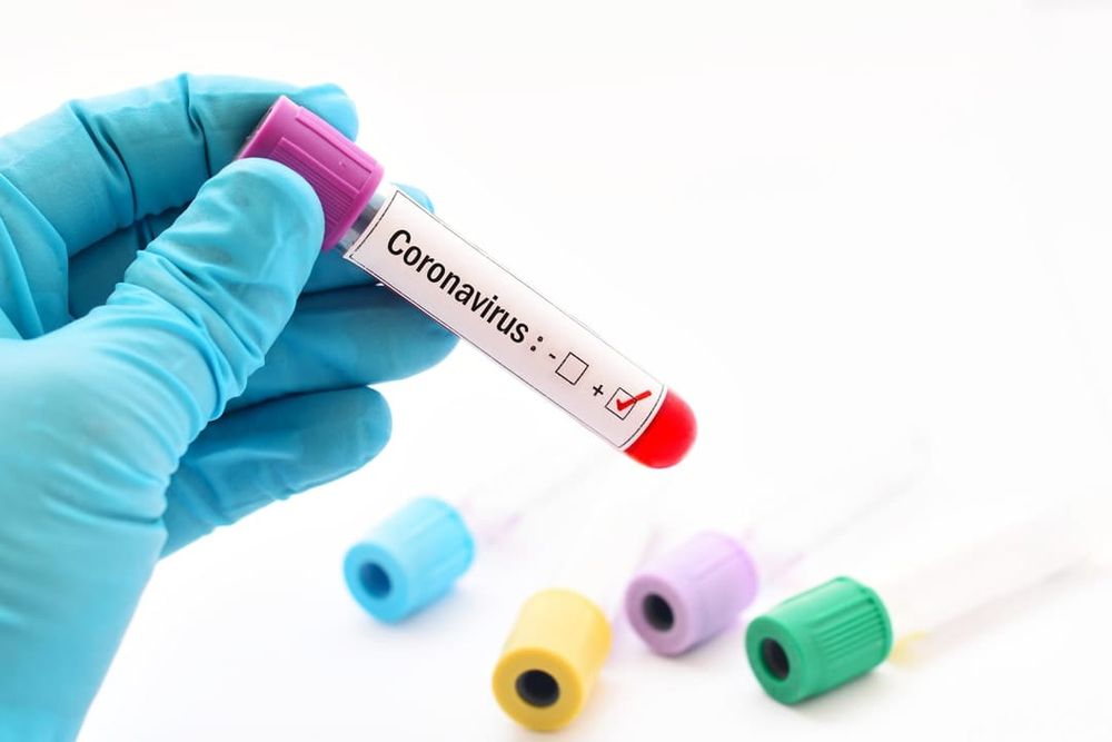 How does the Wuhan coronavirus (COVID-19) cause severe illness? post image