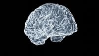 Experimental brain implants are on the rise. What happens after the trials are over? post image